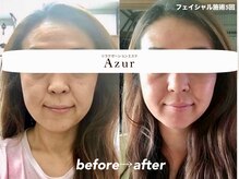 リラクゼーションエステ アジュール(Azur)