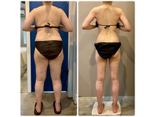 ラヴィニティ 五反田店(Lavinity)の雰囲気(大幅減量でもたるみなし!無理なくキレイに健康に、最後まで♪)