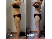 フィエルテ 甲斐敷島(FIERTE)の雰囲気（ハイパーナイフ 痩身30代 女性 90分８回コース 4回目終了）