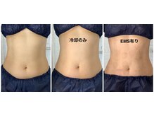 ビューティフルムーン(Beautiful Moon)/冷却一撃コース