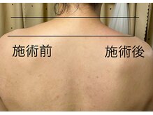 ルリアンデュレ(le lien durer)/首肩こりの解消で魅せる首筋に☆