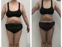 ラヴィアンローズ 岐阜本店(La vie en Rose)の雰囲気（スペシャル集中施術6ヶ月《お腹・二の腕・足・背中》）