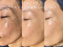 ソリッジ肌管理室