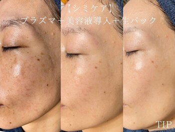 ソリッジ肌管理室の写真/【結果重視オーダーメイドフェイシャル】大人気☆肌質改善!シミケア・しわ改善/くすみなし透明感を手に♪