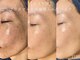 ソリッジ肌管理室の写真/【結果重視オーダーメイドフェイシャル】大人気☆肌質改善!シミケア・しわ改善/くすみなし透明感を手に♪