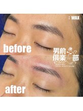男前倶楽部/脱毛/メンズ脱毛/メンズ専門店