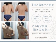 オリ(ORI)