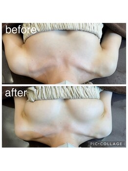 ベルダ(Beldad)/ボンボンバスト