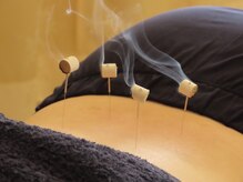 小笠原鍼灸接骨院/鍼灸［所沢/下山口］