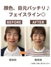 【顔の歪み/エラ張り/小顔矯正】小顔歪み改善コース　初回体験60分¥4,000