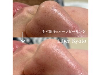 リベルキョウト 京都駅前店(Liber Kyoto)/毛穴レス艶肌コース