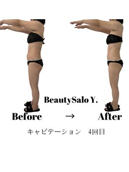 ワイドット(Y.)/ぽっこりお腹