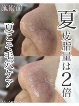 ロカヒ(Lokahi)/毛穴改善コース