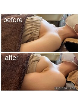 ベルダ(Beldad)/ボンボンバスト