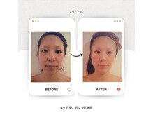 もみかる 静岡本店/別人級！！！