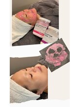 カシェットベルメイユ 名古屋久屋大通(Cachette Vermeil)/ローズ香るジェリーマスク