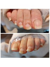 爪切り屋 足楽/爪の向きは