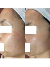 由縁/肌改善プログラム