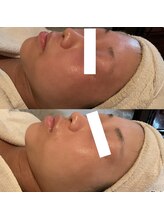 アンジェラックス 福岡天神店/