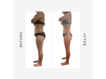 リサスミー(Lithas Me)