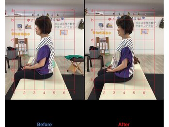 ストレチックス 近江八幡店/BeforeAfter