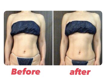 バーテックスキー(Vertexkey)/お腹のケアしてますか？