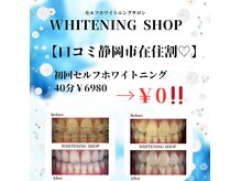 ホワイトニングショップ 静岡葵区店
