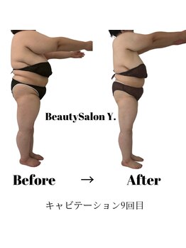 ワイドット(Y.)/人生が激変