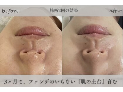 ミロワール(Miroire)の写真