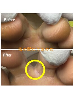 プラスキュア 用賀店(+CURE)/タコうおのめケア60分¥6600~