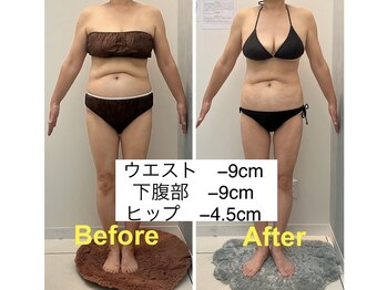 アールボディバランス/【3ヵ月モニター様】50代