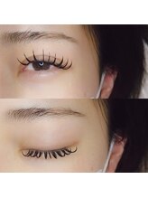 スターリー ラッシュ(Starry Lash)/人気No.1　バインドロック