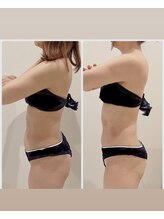 TMサロン 赤坂/3回目で激変！