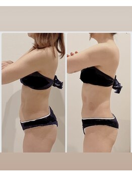 TMサロン 赤坂/3回目で激変！