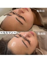 ロミエール 南草津店(LOMIERE)/セルマン ¥11000 (ノーファンデ)