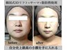 小顔×造顔プレミアム】サーマトリックス×韓国式3D造顔×脂肪分解剤近赤注入