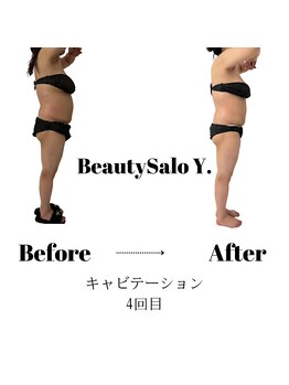 ワイドット(Y.)/ズボンの上にいたお肉はどこへ?