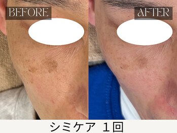 スキンジム(SKIN GYM)/