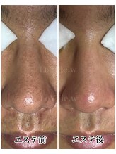 ロイジエ(Loyijie.w)/