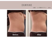 ミライ 福岡筑紫野店(mirai)/なりたいを叶えるボディメイク