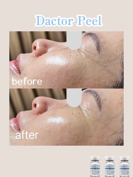 ベルシャトン(Belle Chaton)/ダクトピール