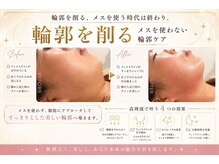 エフリア 大垣(F.lia)の雰囲気（高周波の圧倒的出力で深部へアプローチ！）