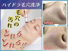 チャーム(CHARME)