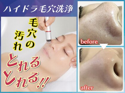 チャーム(CHARME)の写真