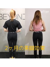 ビヨンド 札幌大通店(BEYOND)/BEYOND大通店は美脚・美尻に特化