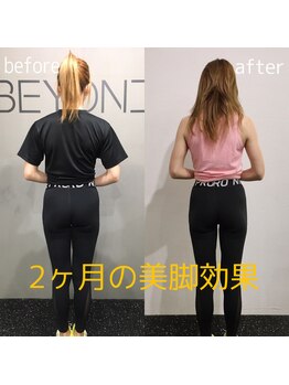 ビヨンド 札幌大通店(BEYOND)/BEYOND大通店は美脚・美尻に特化