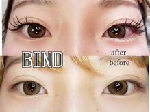 ボニータ(Bonita)/バインドロック[エクステ]