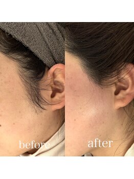 ルブール(levure)/大人気