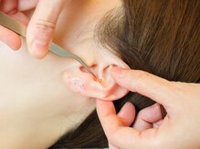 デディア 恵比寿(dedia)/超小顔☆耳つぼ＋脂肪分解施術