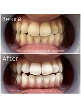 ハピネス 広島並木通り店(Happiness)/１番人気メニュー！